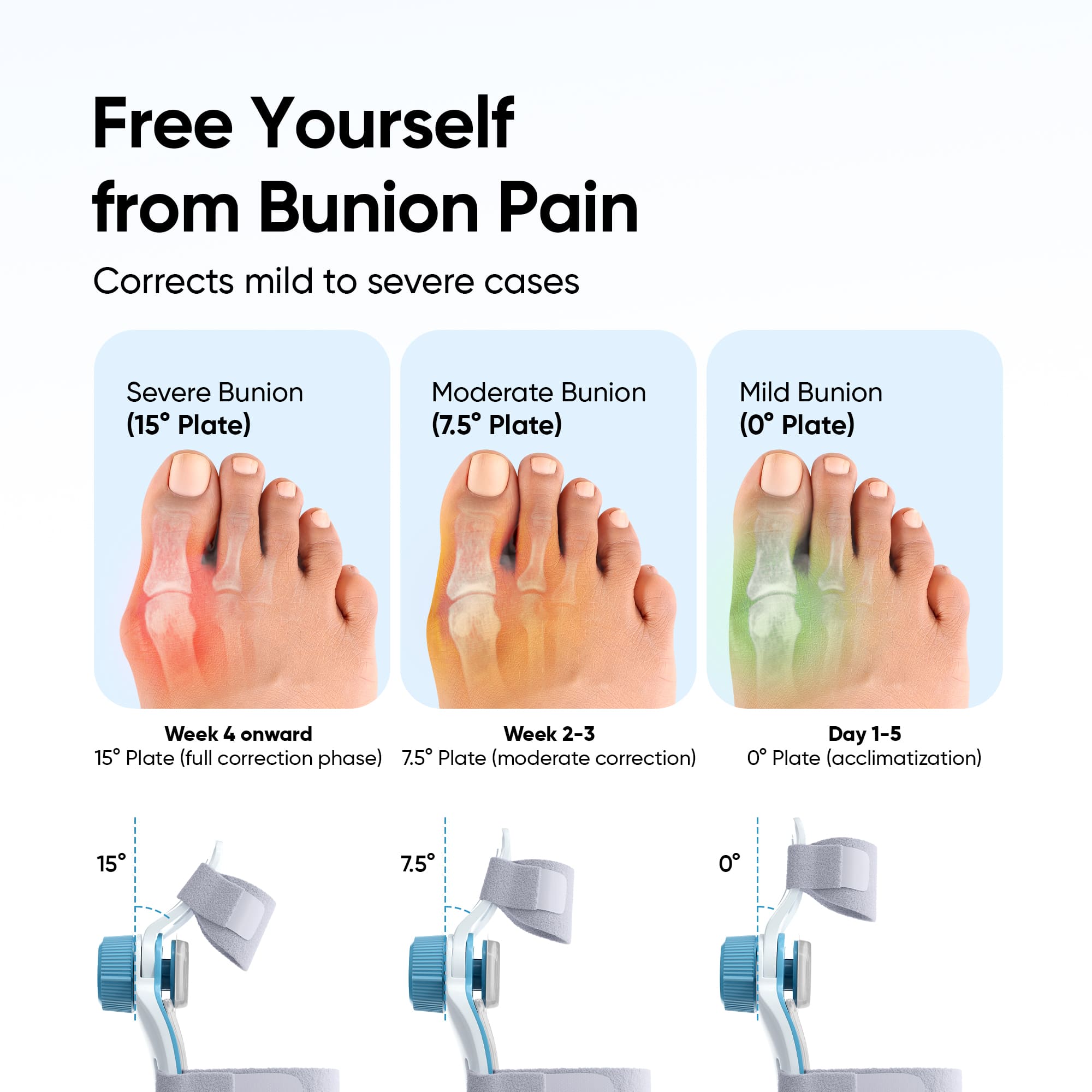 Frido Orthotics Bunion Corrector